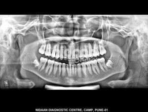 Dental X-Ray Centre Pune